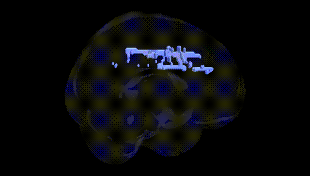 Full Brain Black