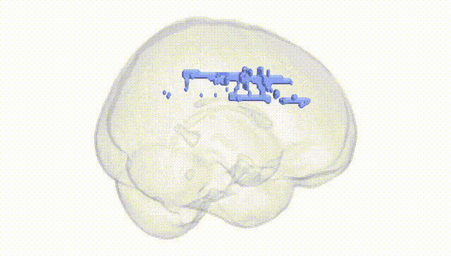 Full Brain White
