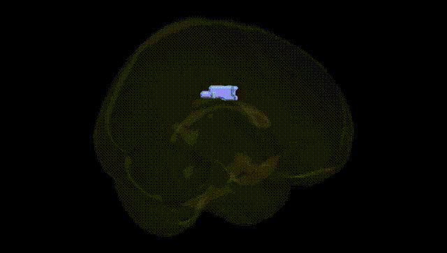 Full Brain Black