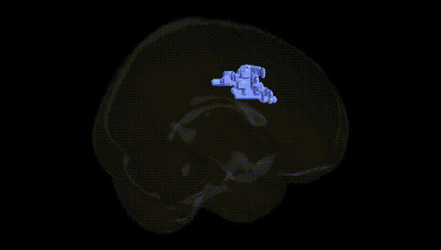 Full Brain Black
