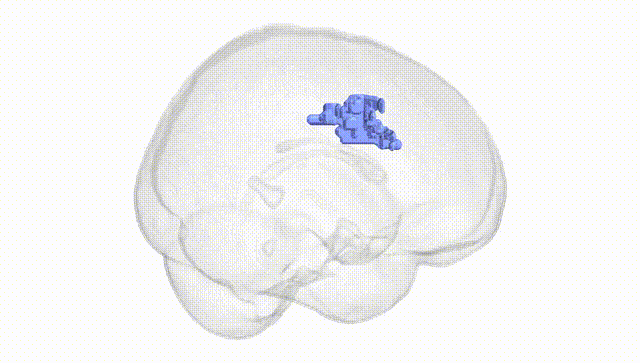 Full Brain White