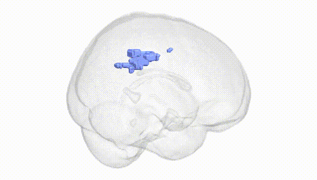 Full Brain White