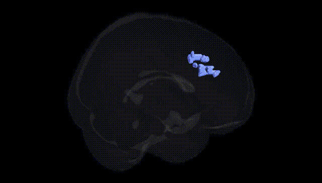 Full Brain Black