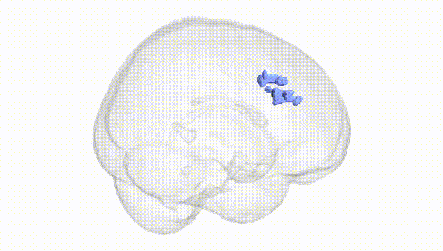 Full Brain White