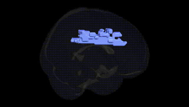 Full Brain Black