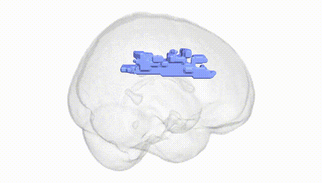 Full Brain White