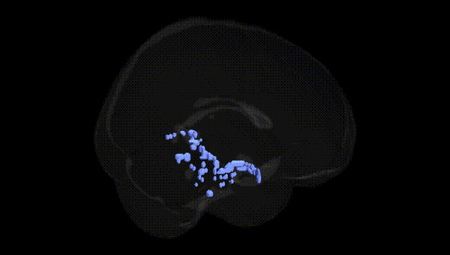Full Brain Black