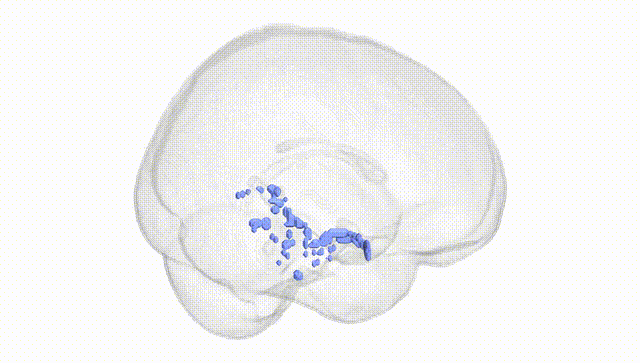 Full Brain White