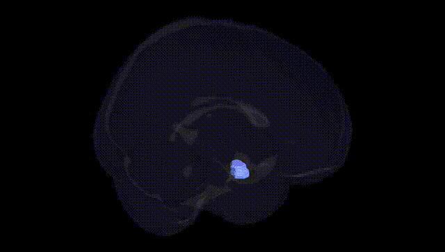Full Brain Black