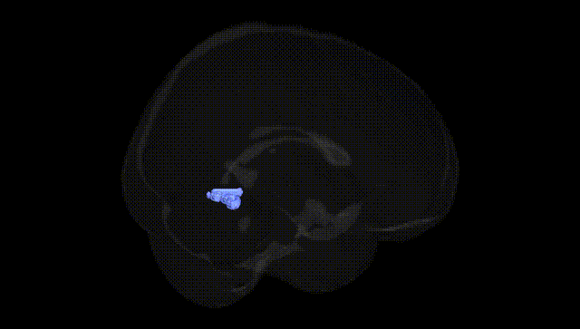Full Brain Black