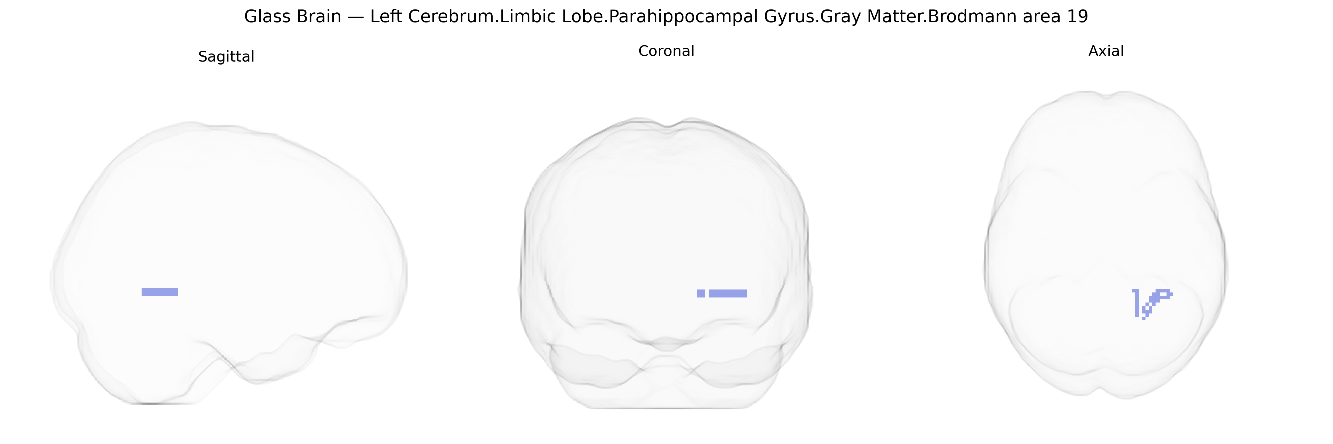Triplanar Ghost Brain