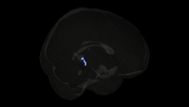 Full Brain Black