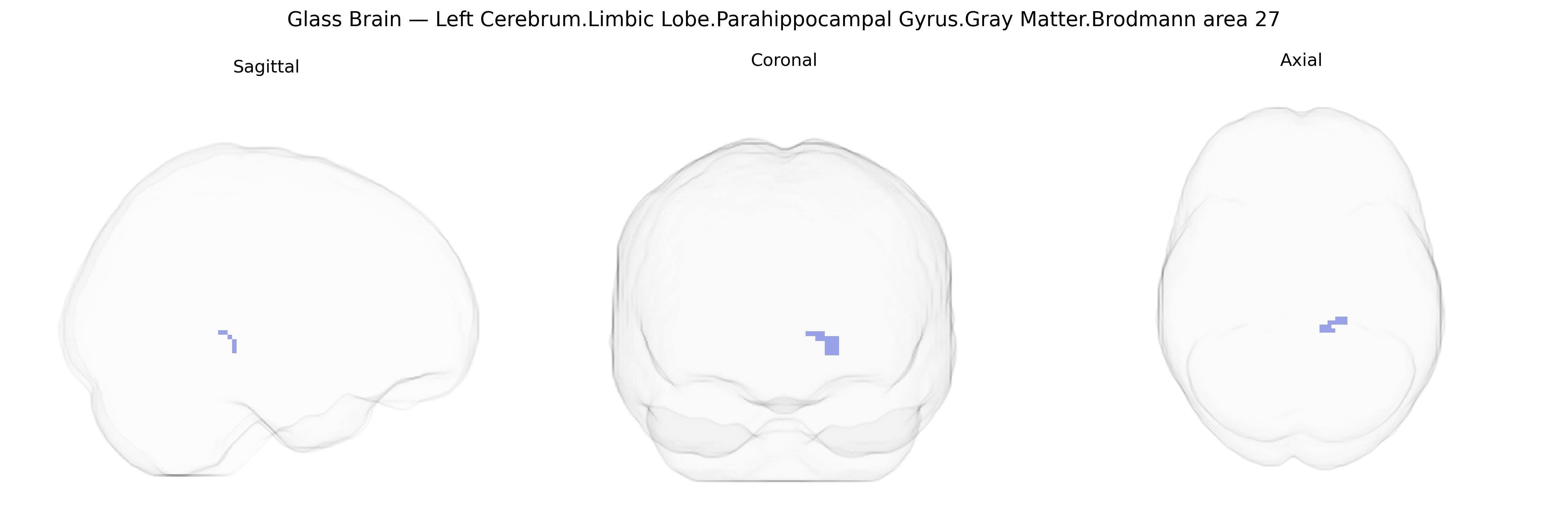 Triplanar Ghost Brain