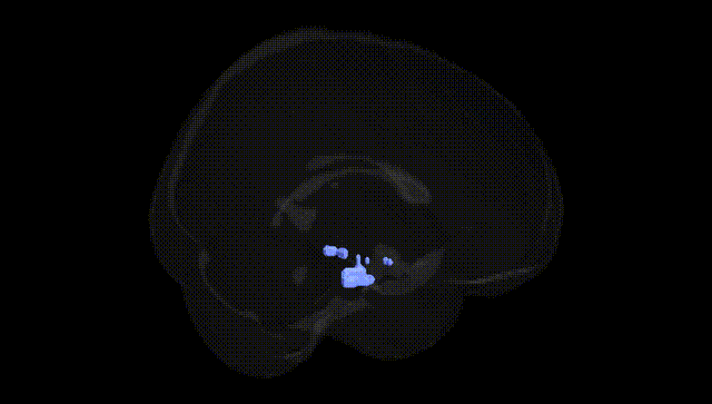 Full Brain Black