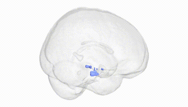 Full Brain White