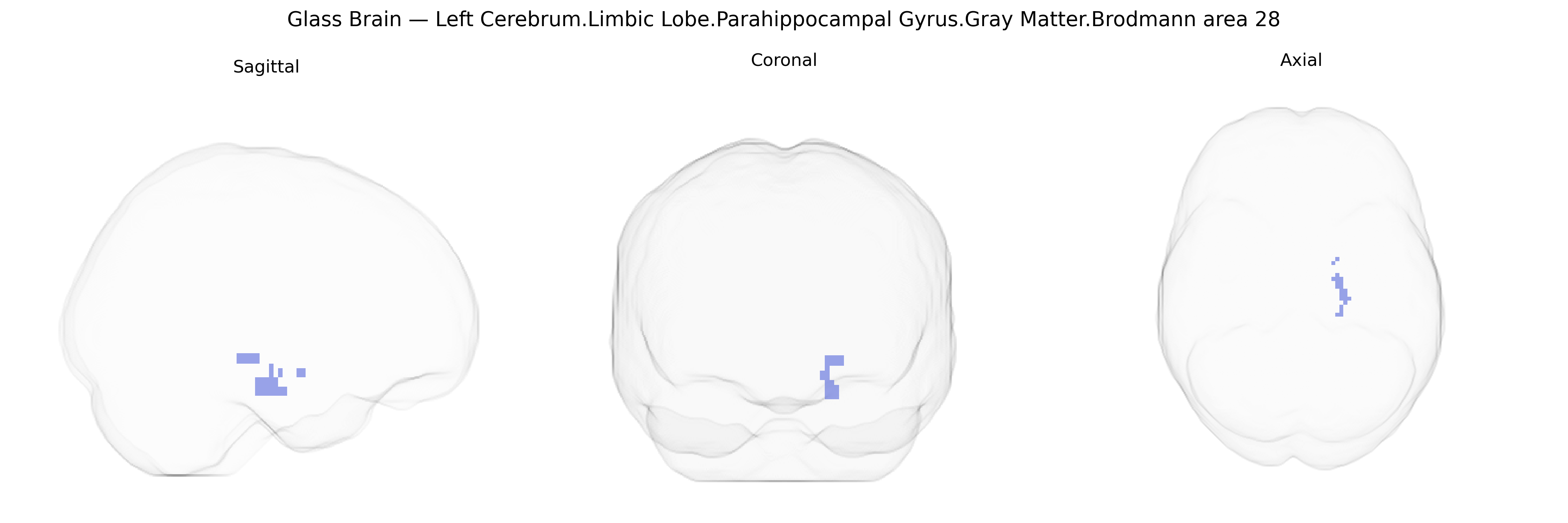 Triplanar Ghost Brain
