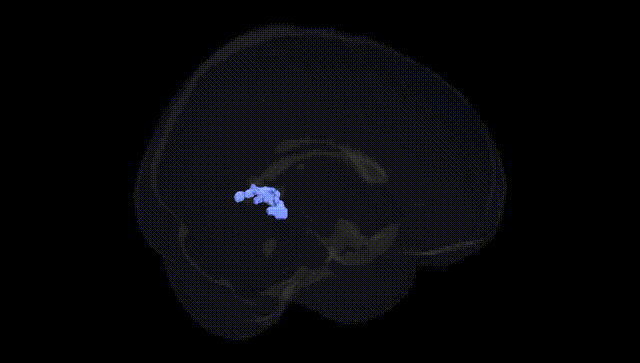 Full Brain Black