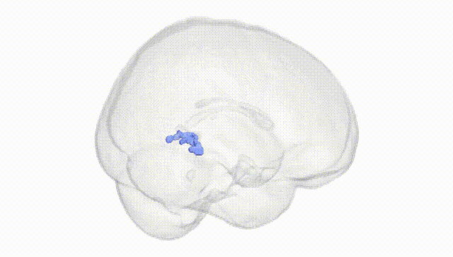 Full Brain White