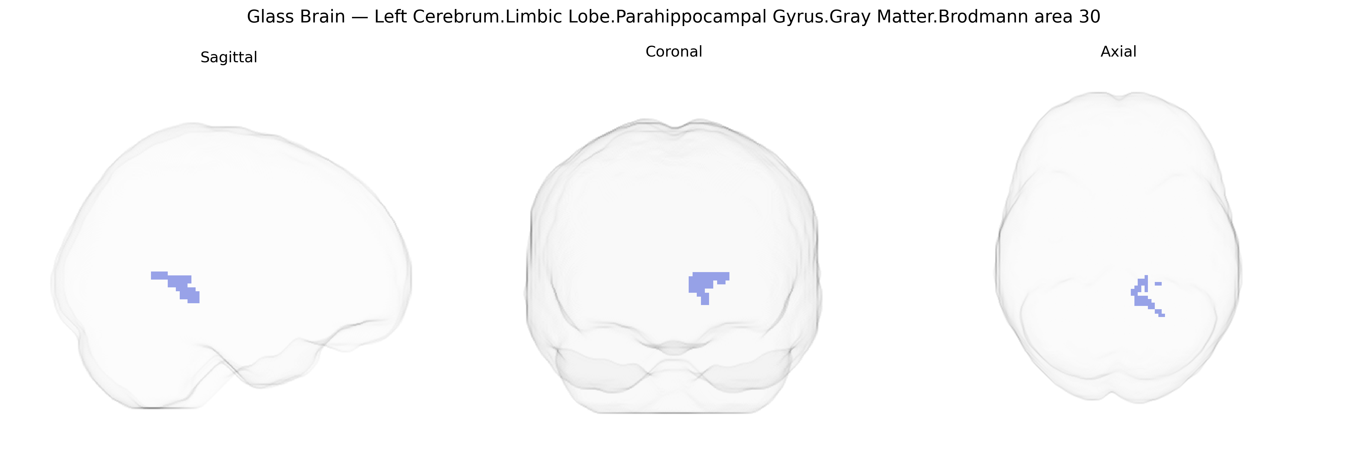 Triplanar Ghost Brain