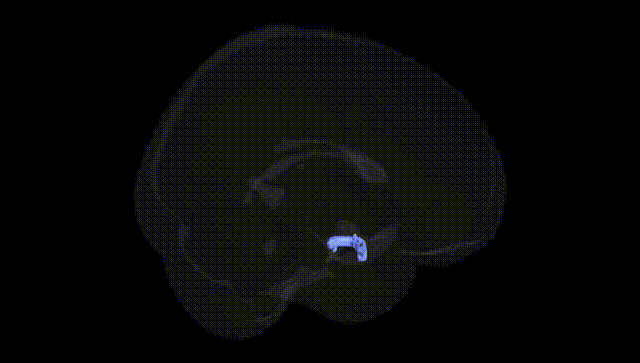 Full Brain Black