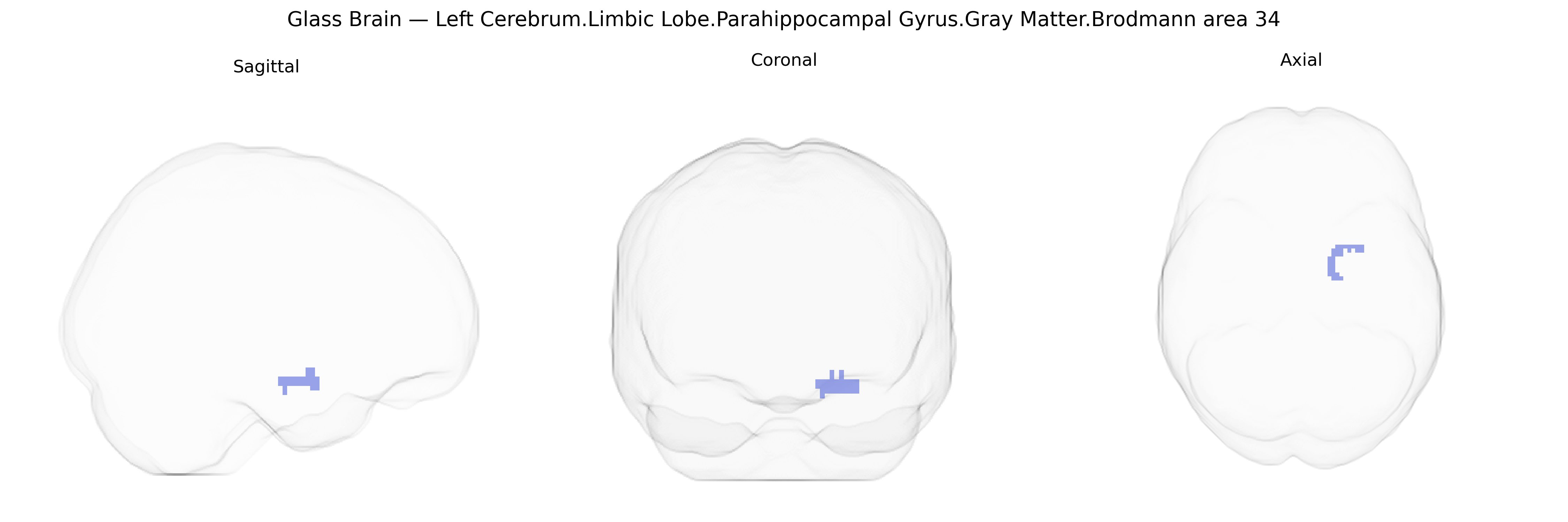 Triplanar Ghost Brain