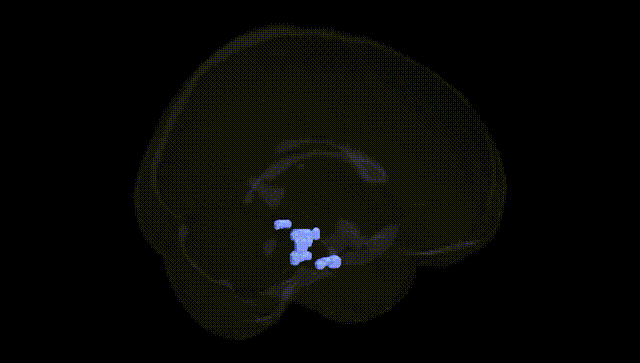 Full Brain Black