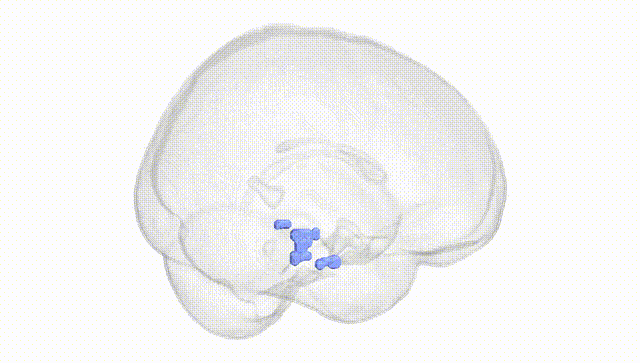 Full Brain White