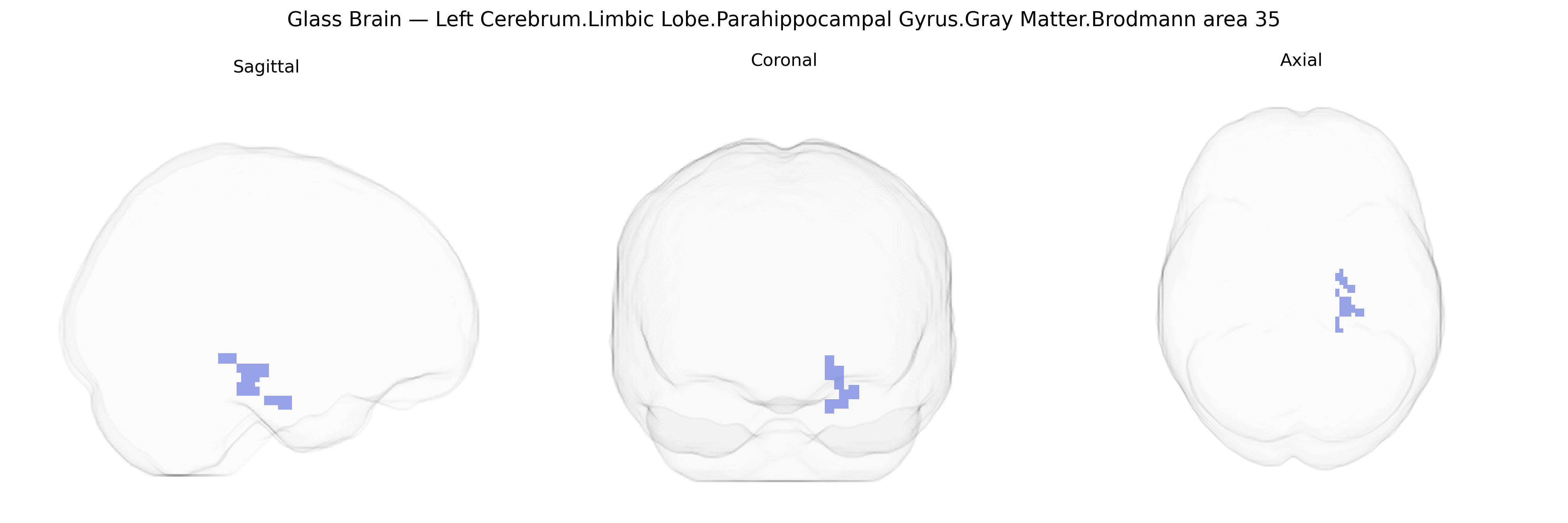 Triplanar Ghost Brain