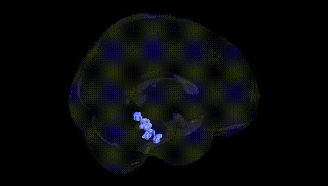 Full Brain Black