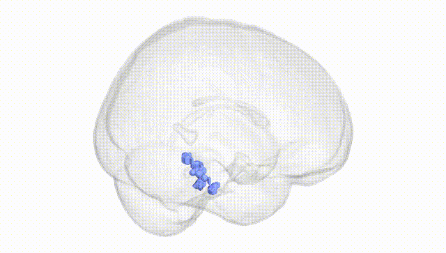 Full Brain White