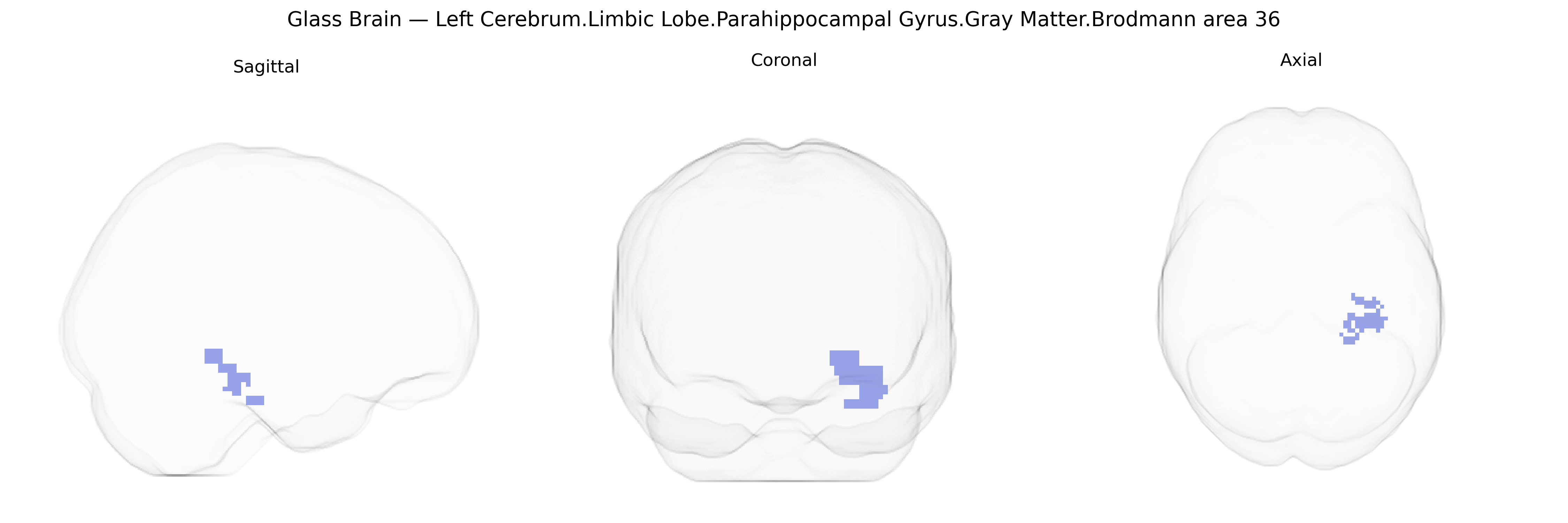 Triplanar Ghost Brain