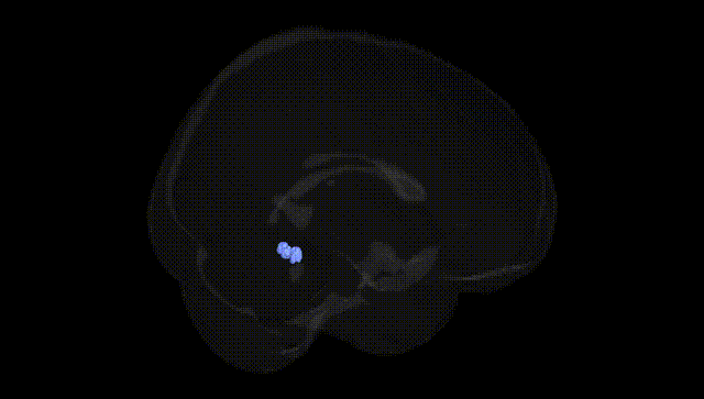 Full Brain Black