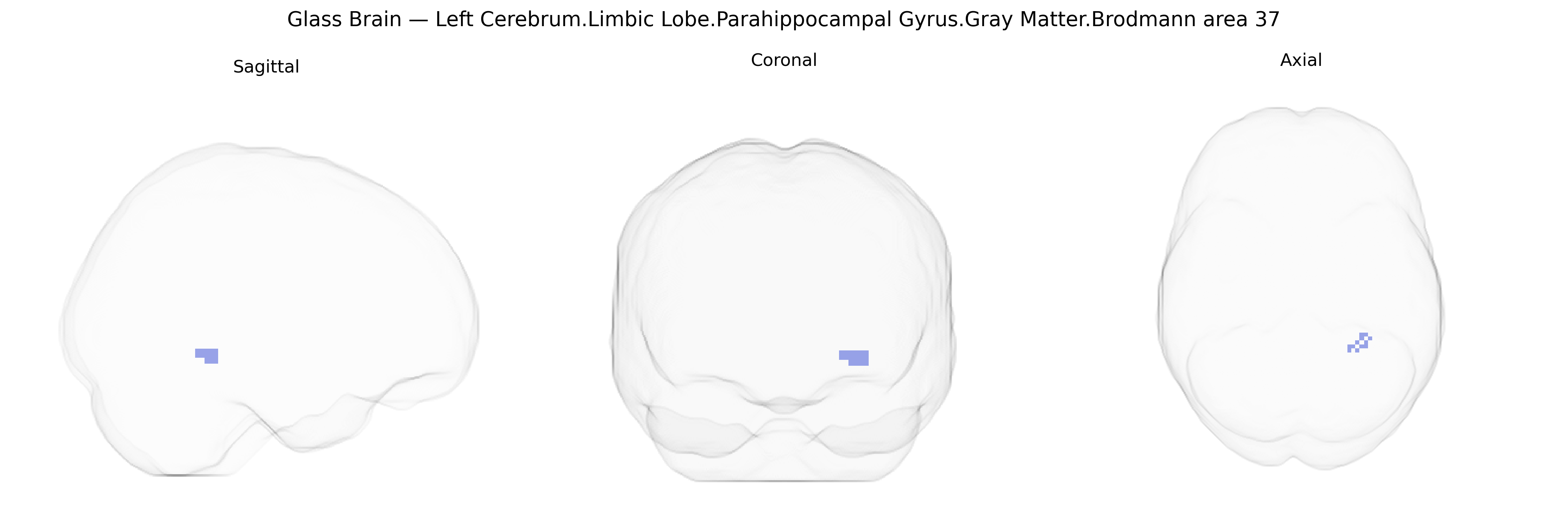 Triplanar Ghost Brain