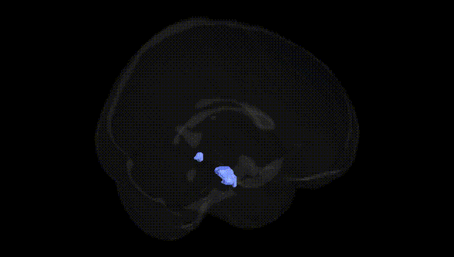 Full Brain Black