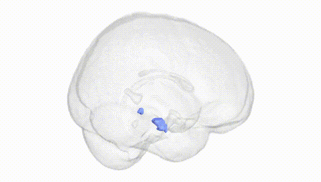 Full Brain White