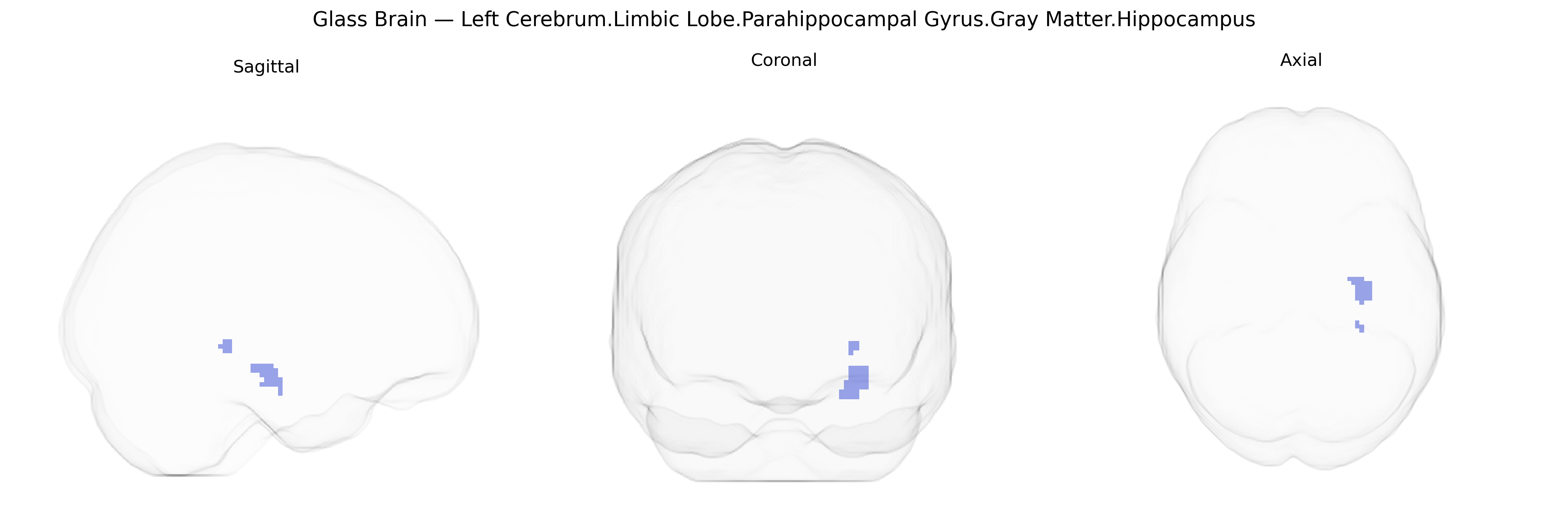 Triplanar Ghost Brain