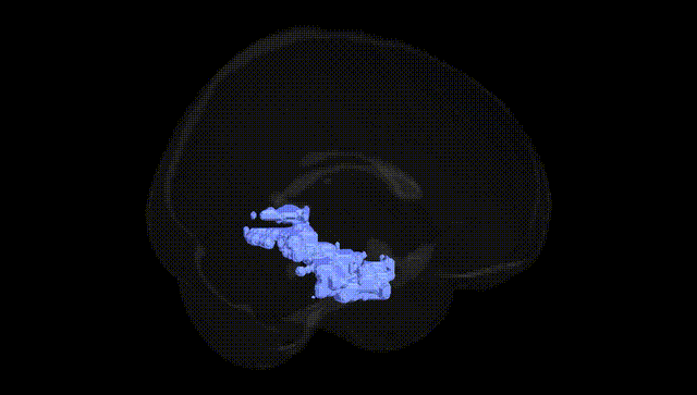 Full Brain Black