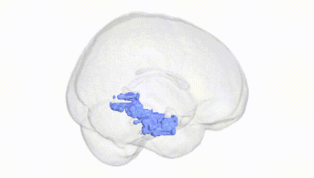 Full Brain White