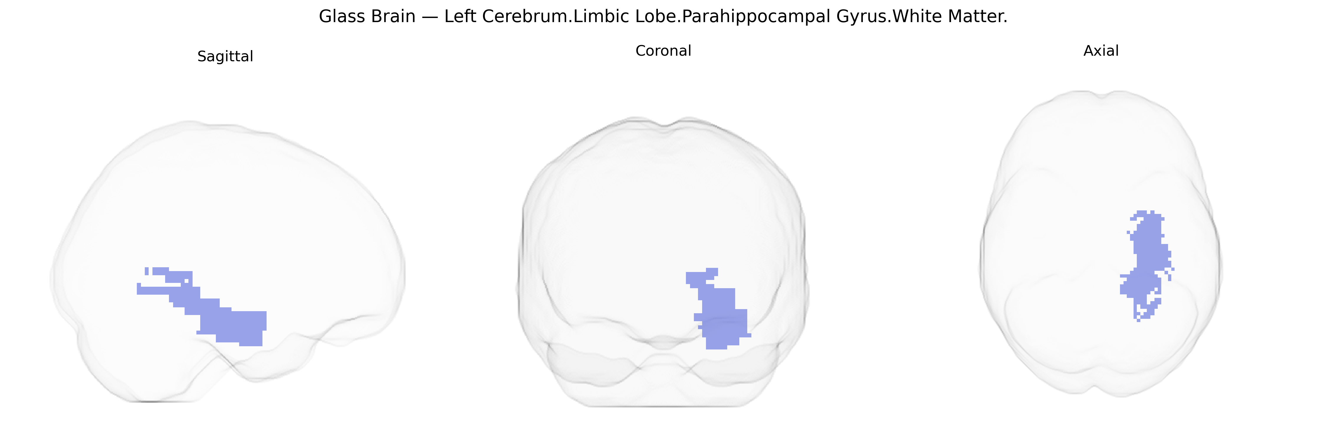 Triplanar Ghost Brain