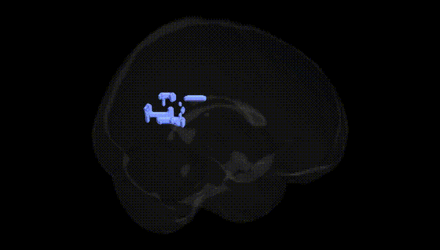 Full Brain Black