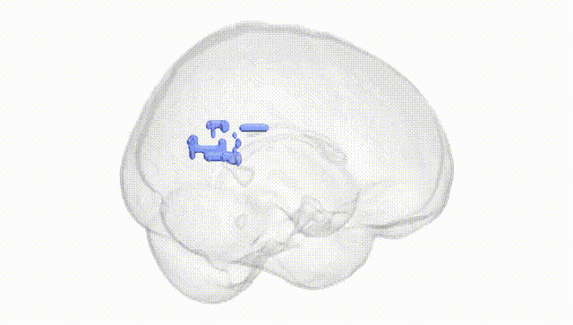 Full Brain White