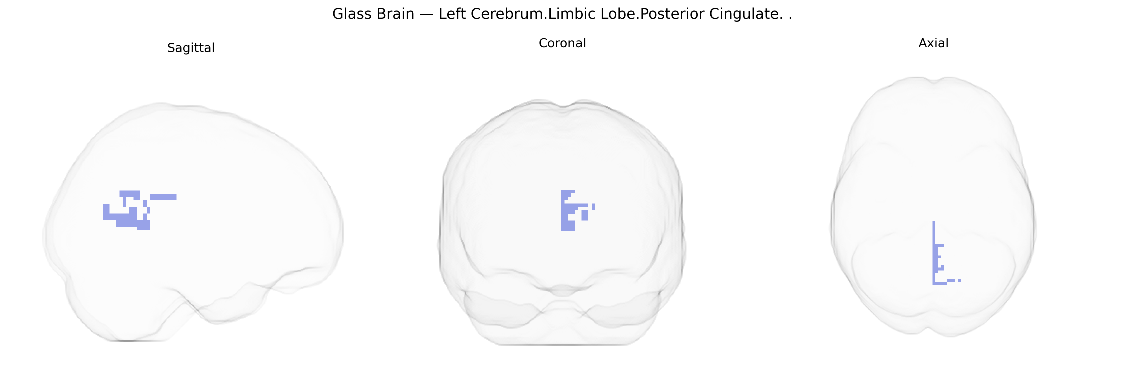 Triplanar Ghost Brain