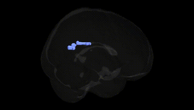Full Brain Black