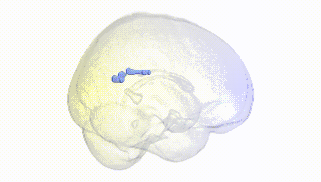Full Brain White