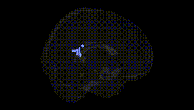 Full Brain Black