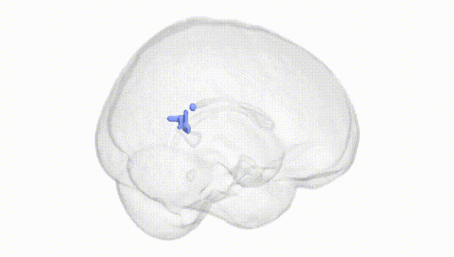 Full Brain White