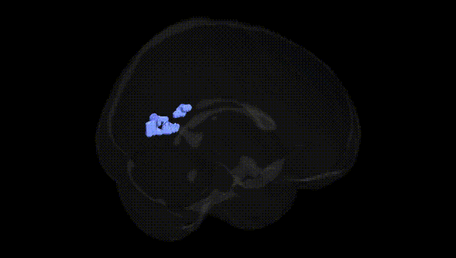 Full Brain Black