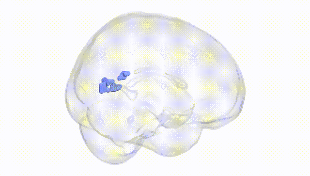 Full Brain White