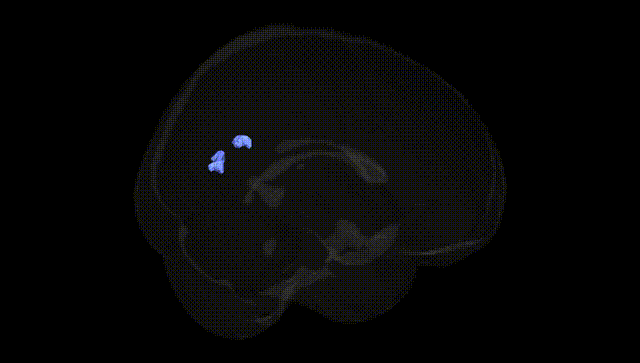 Full Brain Black