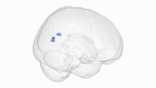 Full Brain White